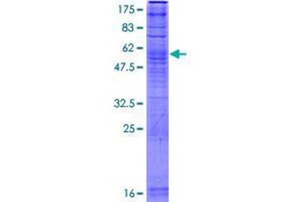 UBIAD1 Protein (AA 1-338) (GST tag)