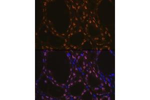 Immunofluorescence analysis of rat thyroid using TTF1 Rabbit mAb (ABIN1679475, ABIN3017648, ABIN3017649 and ABIN7101514) at dilution of 1:100 (40x lens). (NKX2-1 antibody)