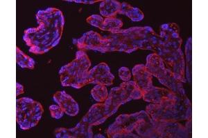 IF analysis of SRPRA using anti-SRPRA antibody (ABIN7601408). (SRPRA (AA 346-638) antibody)