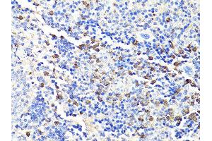 Immunohistochemistry of paraffin-embedded mouse spleen using S100A9 antibody. (S100A9 antibody)