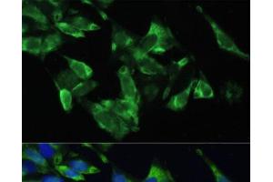 Immunofluorescence analysis of U2OS cells using PMEPA1 Polyclonal Antibody at dilution of 1:100. (PMEPA1 antibody)