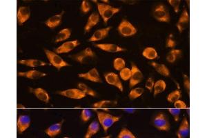 Immunofluorescence analysis of L929 cells using CEP55 Polyclonal Antibody at dilution of 1:100. (CEP55 antibody)