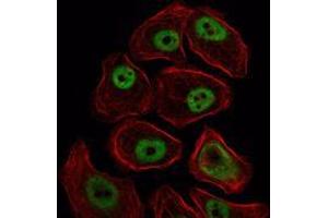 Immunofluorescence analysis of NIH/3T3 cells using SMC1 mouse mAb (green). (SMC1A antibody)