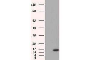 HEK293T cells were transfected with the pCMV6-ENTRY control (Left lane) or pCMV6-ENTRY BIRC5 (Right lane) cDNA for 48 hrs and lysed. (Survivin antibody)