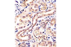 (ABIN6242571 and ABIN6578501) staining KCTD11 in human kidney tissue sections by Immunohistochemistry (IHC-P - paraformaldehyde-fixed, paraffin-embedded sections).
