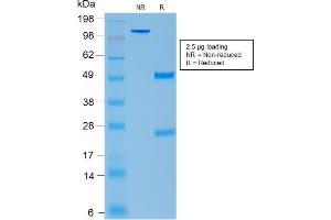 SDS-PAGE Analysis Purified ACTH Mouse Recombinant Monoclonal Antibody (rCLIP/1407). (POMC antibody  (AA 25-39))