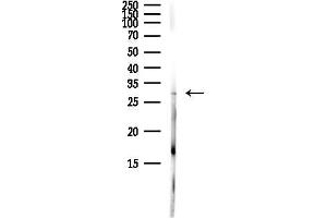anti-DnaJ (Hsp40) Homolog, Subfamily C, Member 5 (DNAJC5) (Internal Region) antibody