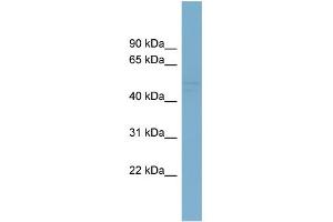 WB Suggested Anti-SMYD2 Antibody Titration:  0. (SMYD2A antibody  (N-Term))