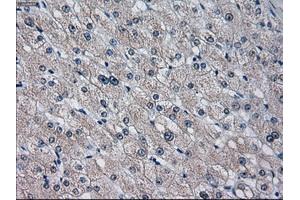 Immunohistochemical staining of paraffin-embedded endometrium tissue using anti-CYP2E1 mouse monoclonal antibody.