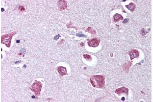 Human Brain, Cortex (formalin-fixed, paraffin-embedded) stained with RELA antibody ABIN218582 at 1:500 followed by biotinylated goat anti-rabbit IgG secondary antibody ABIN481713, alkaline phosphatase-streptavidin and chromogen. (NF-kB p65 antibody  (pSer529))