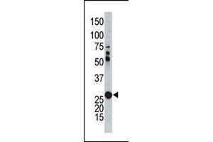 The anti-AK2 Pab (ABIN392741 and ABIN2842198) is used in Western blot to detect AK2 in mouse kidney tissue lysate. (Adenylate Kinase 2 antibody  (N-Term))