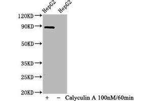 Western Blot Positive WB detected in HepG2 whole cell lysate(treated with Calyculin A or not) All lanes Phospho-STAT1 antibody at 1. (Recombinant STAT1 antibody  (pSer727))