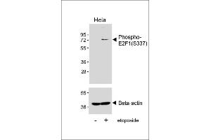 Western blot analysis of lysates from Hela cell line, untreated or treated with etoposide(25μM, 24h), using Phospho-E2F1 Antibody (upper) or Beta-actin (lower). (E2F1 antibody  (pSer337))