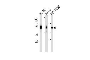 LCK Antibody ABIN1882258 western blot analysis in HL-60,Jurkat,NCI- cell line lysates (35 μg/lane). (LCK antibody)