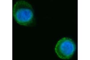IF analysis of Septin 2/SEPTIN2 using anti-Septin 2/SEPTIN2 antibody (ABIN7599275).