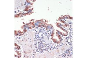 Immunohistochemistry of paraffin-embedded rat lung using Musashi-1 (Musashi-1 (MSI1)) antibody (ABIN6134835, ABIN6144067, ABIN6144068 and ABIN6219720) at dilution of 1:200 (40x lens). (MSI1 antibody  (AA 1-100))