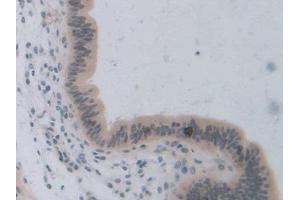 Immunohistochemistry (IHC) image for anti-Transcription Factor 20 (TCF20) (AA 1871-1965) antibody (ABIN7438469)