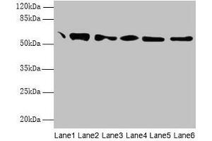 Western blot All lanes: P4HB antibody at 1. (P4HB antibody  (AA 29-508))