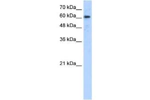 ADAM30 antibody used at 5 ug/ml to detect target protein. (ADAM30 antibody  (N-Term))