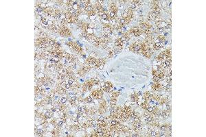 Immunohistochemistry of paraffin-embedded rat liver using IVD antibody (ABIN7268031) at dilution of 1:100 (40x lens). (IVD antibody  (AA 33-200))