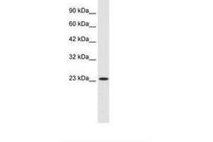 Image no. 2 for anti-Kv Channel Interacting Protein 2 (KCNIP2) (AA 22-71) antibody (ABIN6735459) (KCNIP2 antibody  (AA 22-71))