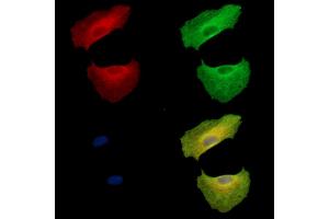 ABIN7095041 and ABIN7099097 staining  cells by IF/ICC. (SBEM antibody)
