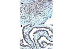 Immunohistochemical staining (Formalin-fixed paraffin-embedded sections) of human tonsil (A) and human ovarian carcinoma (B) with Histone H1 monoclonal antibody, clone AE-4 . (Histone H1 antibody)