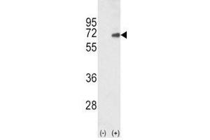 Western blot analysis of SMAD4 antibody and 293 cell lysate (2 ug/lane) either nontransfected (Lane 1) or transiently transfected with the human gene (2). (SMAD4 antibody  (AA 400-428))