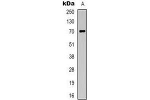 Western blot analysis of Taurine Transporter expression in Jurkat (A) whole cell lysates. (TAUT antibody  (C-Term))