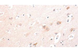 Immunohistochemistry of paraffin-embedded Human brain using TRAF3IP1 Polyclonal Antibody at dilution of 1:70 (TRAF3IP1 antibody)