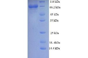 SDS-PAGE (SDS) image for Calpastatin (ICAL) (AA 1-667), (partial) protein (His tag) (ABIN5709207)