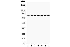 Western blot testing of MAD1 antibody and human samples 1:  A549;  2: Jurkat;  3: HeLa;  4: 293T;  5: SHG-44;  6: 22RV1;  7: PANC lysate. (PSMD14 antibody  (AA 362-632))