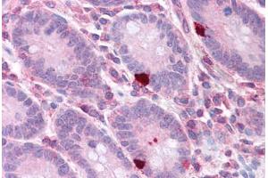 Human Small Intestine: Formalin-Fixed, Paraffin-Embedded (FFPE) (EEF2 antibody  (AA 36-85))
