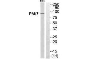Western blot analysis of extracts from rat brain cells, using PAK7 antibody. (PAK7 antibody  (C-Term))