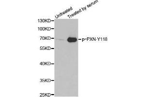 Western blot analysis of extracts from 3T3 cells, using phospho-PXN-Y118 antibody. (Paxillin antibody  (pTyr118))