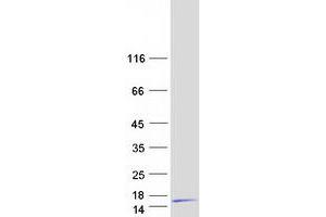 Validation with Western Blot