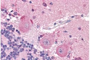 Human Brain, Cerebellum (formalin-fixed, paraffin-embedded) stained with SLC6A3 antibody ABIN298105 at 20 ug/ml followed by biotinylated goat anti-rabbit IgG secondary antibody ABIN481713, alkaline phosphatase-streptavidin and chromogen. (SLC6A3 antibody  (N-Term))