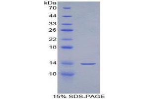 SDS-PAGE (SDS) image for Alanine Aminotransferase (ALT) (AA 147-263) protein (His tag) (ABIN1169805) (ALT Protein (AA 147-263) (His tag))
