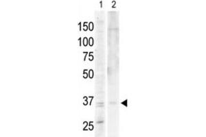 Western Blotting (WB) image for anti-PKA C-Alpha,PKA C-beta antibody (ABIN3002928) (PKA C-Alpha,PKA C-beta antibody)