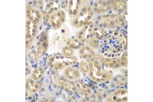 Immunohistochemistry of paraffin-embedded mouse kidney using SULT2B1 antibody (ABIN2737623) at dilution of 1:100 (40x lens). (SULT2B1 antibody)