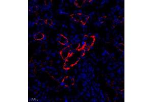 Immunofluorescence analysis of paraffin embedded rat nephritis using CD35 (ABIN7073563) at dilution of 1: 650 (CD35 antibody)