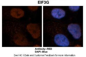 Immunohistochemistry (IHC) image for anti-Eukaryotic Translation Initiation Factor 3, Subunit G (EIF3G) (Middle Region) antibody (ABIN2778865)