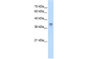 Loricrin antibody used at 5 ug/ml to detect target protein. (LOR antibody  (N-Term))