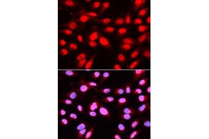 Immunofluorescence analysis of U2OS cells using U2AF2 antibody (ABIN5971000). (U2AF2 antibody)