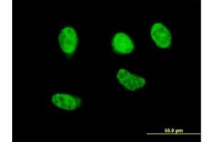 Immunofluorescence of monoclonal antibody to NFE2L2 on HeLa cell. (NRF2 antibody  (AA 71-170))