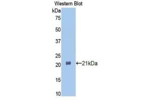 Detection of Recombinant HSPBP1, Mouse using Polyclonal Antibody to Heat Shock 70 kDa Binding Protein 1 (HSPBP1) (HSPBP1 antibody  (AA 209-354))