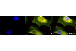 Immunocytochemistry/Immunofluorescence analysis using Rabbit Anti-SOD1 (UBB) Polyclonal Antibody . (SOD1 antibody  (N-Term) (Atto 594))