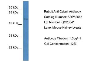 Western Blotting (WB) image for anti-Collagen and Calcium Binding EGF Domains 1 (CCBE1) (C-Term) antibody (ABIN2784990) (CCBE1 antibody  (C-Term))