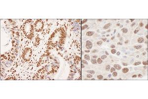 Immunohistochemistry (IHC) image for anti-Heterogeneous Nuclear Ribonucleoprotein K (HNRNPK) (AA 300-350) antibody (ABIN7454659)