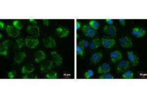 ICC/IF Image UQCRFS1 antibody [N1C3] detects UQCRFS1 protein at mitochondria by immunofluorescent analysis. (UQCRFS1 antibody)
